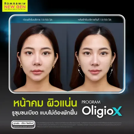ฝน ปริตา ไชยรักษ์