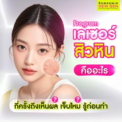 เลเซอร์สิวหิน คืออะไร? บอกลาตุ่มเม็ดเล็ก รอบดวงตาให้เนียน