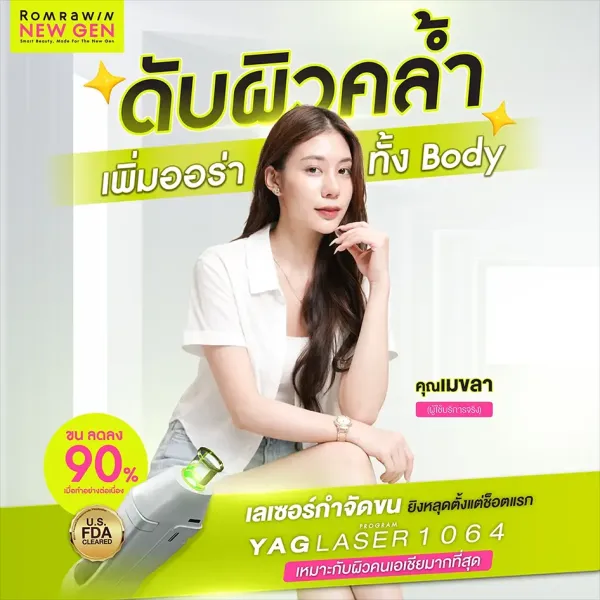 รีวิวเลเซอร์ขน YAG LASER 1064 จากคุณเมขลา ทำแล้วผิวใสมาก