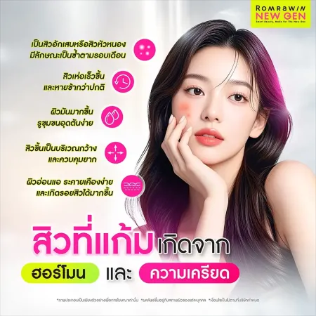 สิวที่แก้มเกิดจาก