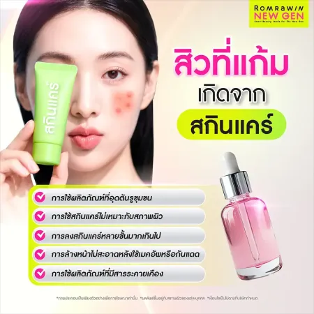 สิวที่แก้มเกิดจาก