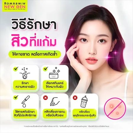 สิวที่แก้มเกิดจาก