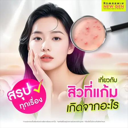 สิวที่แก้มเกิดจาก