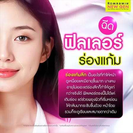ฟิลเลอร์