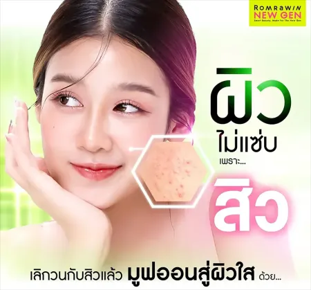 วิธีเลือกคลินิกกดสิวใกล้ฉันอย่างถูกวิธี เคลียร์สิวอุดตันไม่ทิ้งรอย
