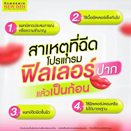หลังฉีดฟิลเลอร์ปาก
