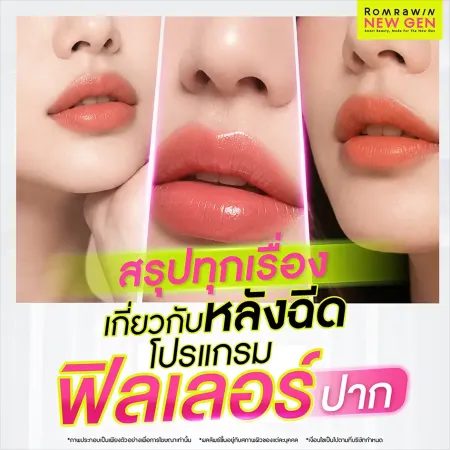 สรุปทุกเรื่องเกี่ยวกับหลังฉีดโปรแกรมฟิลเลอร์ปาก