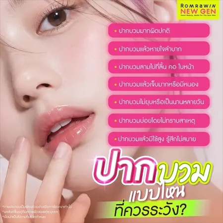 อินโฟกราฟิกเตือนภัยหัวข้อปากบวมแบบไหนที่ควรระวัง พร้อมรายละเอียดเช็กลิสต์อาการอันตรายรอบริมฝีปากที่ต้องพบแพทย์