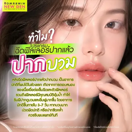 อินโฟกราฟิกความรู้หัวข้อทำไมโปรแกรมฉีดฟิลเลอร์ปากแล้วปากบวม พร้อมข้อมูลอธิบายระยะเวลาการยุบบวมของริมฝีปาก