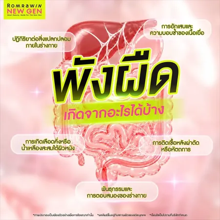 พังผืด