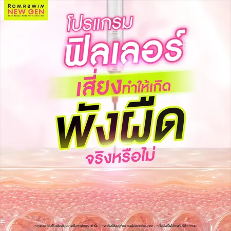 พังผืด