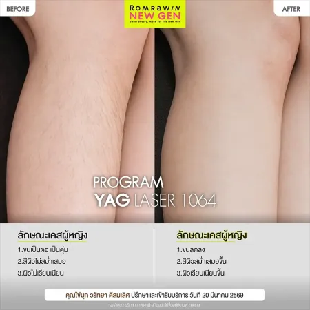 คุณไข่มุก วรัทยา ดีสมเลิศ