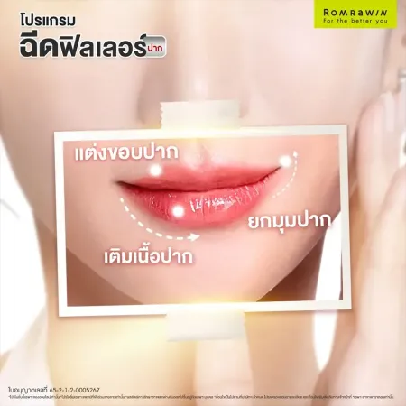ฟิลเลอร์ปาก