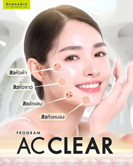 โปรแกรม AC CLEAR รักษาสิวอุดตัน สิวอักเสบ สิวหัวขาว และสิวหัวหนองอย่างตรงจุด