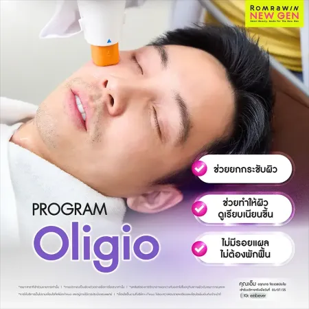 รีวิว PROGRAM Oligio ช่วยยกกระชับผิว ช่วยทำให้ผิวดูเรียบเนียนขึ้น ภาพเคสรีวิวเปรียบเทียบผลลัพธ์การยกกระชับแก้มของผู้ชายขณะรับบริการ