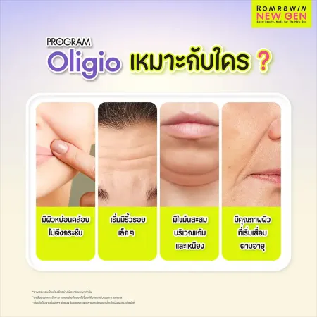 PROGRAM Oligio เหมาะกับใคร ภาพกราฟิกจำลองปัญหาผิวพรรณเช่นผิวหน้าหย่อนคล้อยเริ่มมีริ้วรอยเล็กๆและมีไขมันสะสมแก้มเหนียง