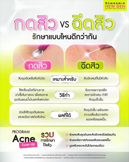 เปรียบเทียบกดสิว VS ฉีดสิว รักษาแบบไหนดีกว่ากัน เหมาะกับสิวประเภทไหน