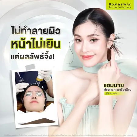 สิวฮอร์โมน