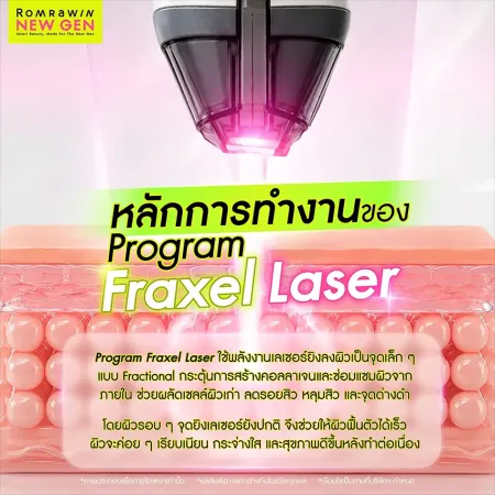 Fraxel Laser
