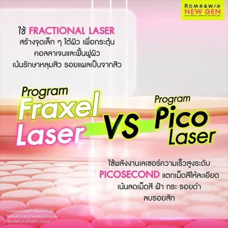 Fraxel Laser