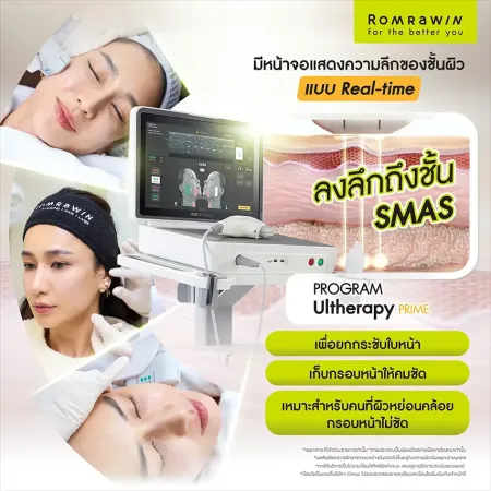 รีวิว Ultherapy Prime สแกนชั้นผิว Real-time ยกลึกถึง SMAS