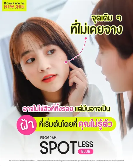 รักษาฝ้ากระ
