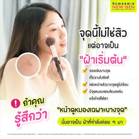 รักษาฝ้ากระ
