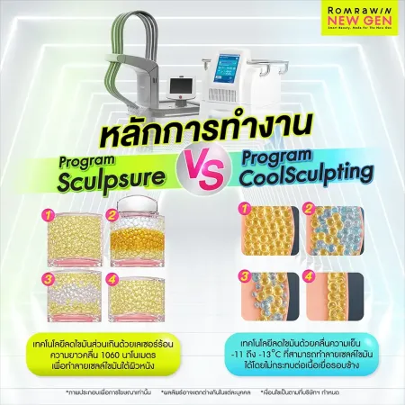Sculpsure กับ Coolsculpting
