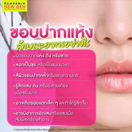 ขอบปากแห้ง