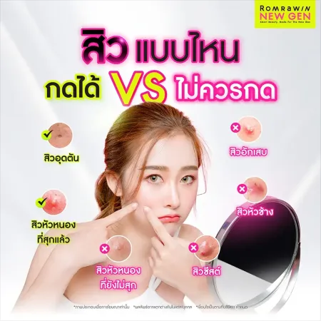 เปรียบเทียบสิวแบบไหนกดได้กับไม่ควรกด เพื่อป้องกันรอยสิวอักเสบ