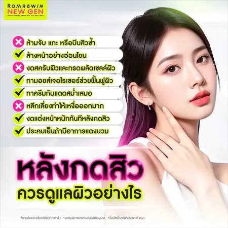 วิธีดูแลผิวหลังกดสิวอย่างถูกวิธี ห้ามจับแกะ ทามอยส์เจอไรเซอร์ ป้องกันรอยสิว