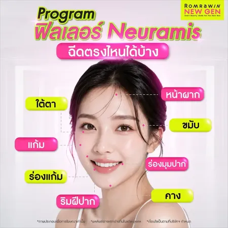ฟิลเลอร์ Neuramis