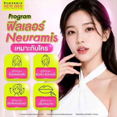 ฟิลเลอร์ Neuramis