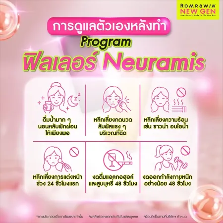 ฟิลเลอร์ Neuramis