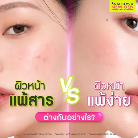 ความแตกต่างระหว่างผิวหน้าแพ้สารกับผิวหน้าแพ้ง่าย สังเกตอาการและการดูแล