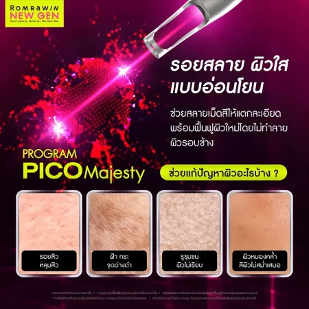 ชวนเช็กปัญหาสภาพผิวหน้าสารพัดรูปแบบที่สามารถแก้ไขได้ด้วยโปรแกรม Pico Majesty รมย์รวินท์คลินิก