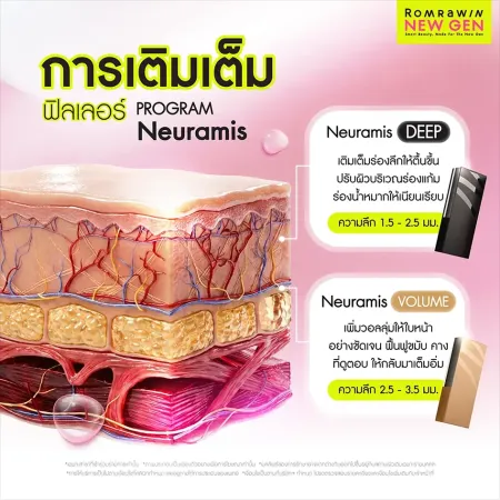 ฟิลเลอร์ Neuramis