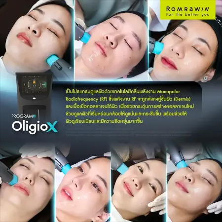 บรรยากาศผู้ใช้บริการจริงทำโปรแกรม Oligio X ยกกระชับผิว