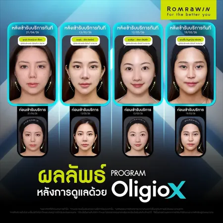 ภาพเปรียบเทียบผลลัพธ์ก่อนหลังทำโปรแกรม Oligio X จากผู้ใช้บริการจริง