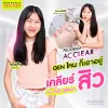 รีวิวรักษาสิว AC Clear เผยผิวเนียนใส ไร้รอยสิว คุณยูจิน