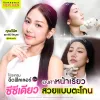 รีวิวฟิลเลอร์คาง 1cc เคล็ดลับหน้าเรียวสวย คุณวีนัส