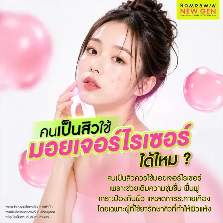 คนเป็นสิวใช้มอยเจอร์ไรเซอร์ได้ไหม ช่วยเติมความชุ่มชื้น ลดระคายเคืองจากการใช้ยาสิว