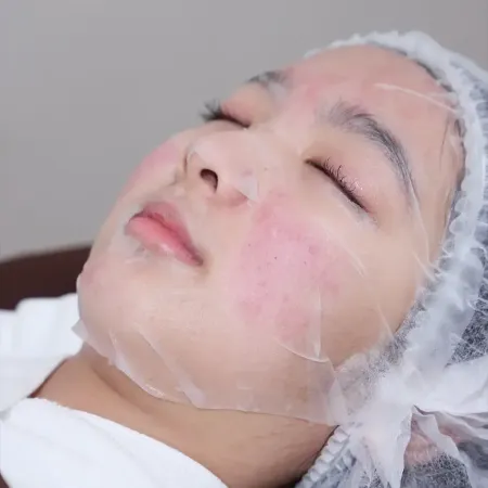 ทรีตเมนต์เติมความชุ่มชื้น ฟื้นฟูเกราะป้องกันผิวเป็นสิว