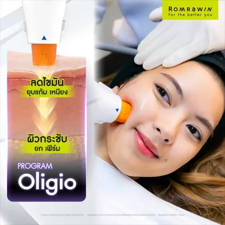 รีวิว Oligio ลดไขมัน ยุบแก้ม เหนียง ผิวกระชับ ยก เฟิร์ม ภาพเคสรีวิวเปรียบเทียบก่อนและหลังทำหัตถการยกกระชับใบหน้าของผู้หญิง