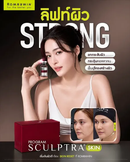 อินโฟกราฟิกโปรแกรม Sculptra Skin Romrawin แสดงภาพนางแบบถือขวดผลิตภัณฑ์พร้อมภาพเปรียบเทียบก่อนหลังทำรีวิวลิฟท์ผิวแก้ม