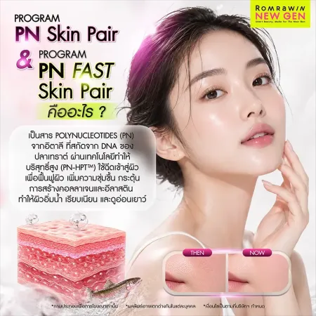 รีวิวโปรแกรม PN Skin หรือสารสกัดพอลินิวคลีโอไทด์สากล Plinest ตัวช่วยกู้ผิวพังชุ่มชื้นเรียบเนียนระดับเซลล์ของรมย์รวินท์คลินิก