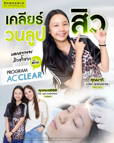 AC Clear เคสรีวิวคุณมากิเปรียบเทียบผิวก่อนและหลังทำโปรแกรมเคลียร์สิววนลูป
