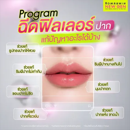 ฉีดฟิลเลอร์ปาก แก้ปัญหาอะไรได้บ้าง โปรแกรมปรับโครงสร้างทรงปาก