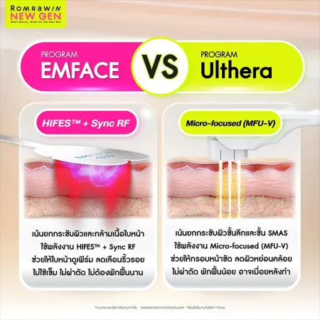 เปรียบเทียบ Program EMFACE กับ Program Ulthera ต่างกันอย่างไร
