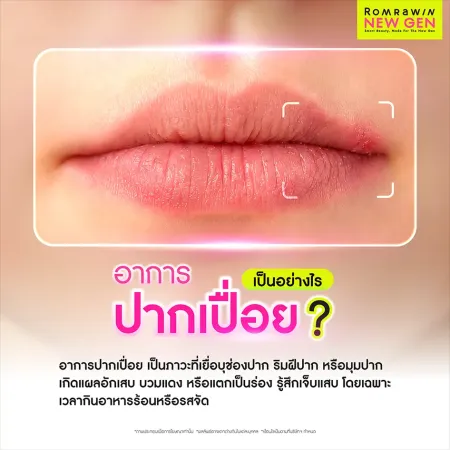 อาการปากเปื่อย สังเกตลักษณะแผลอักเสบบวมแดงริมฝีปาก